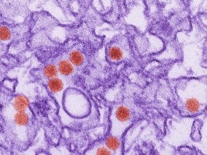 Zika